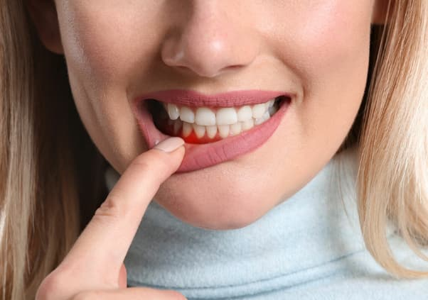 what causes gum disease